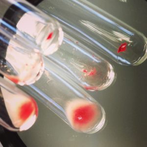 Close up of glass vials, each containing a small amount of blood